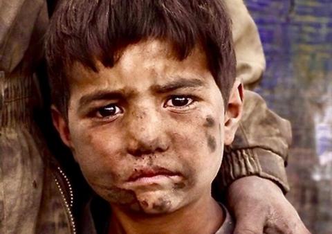 Close up image of a refugee child looking directly towards us, their face smeared with dirt 